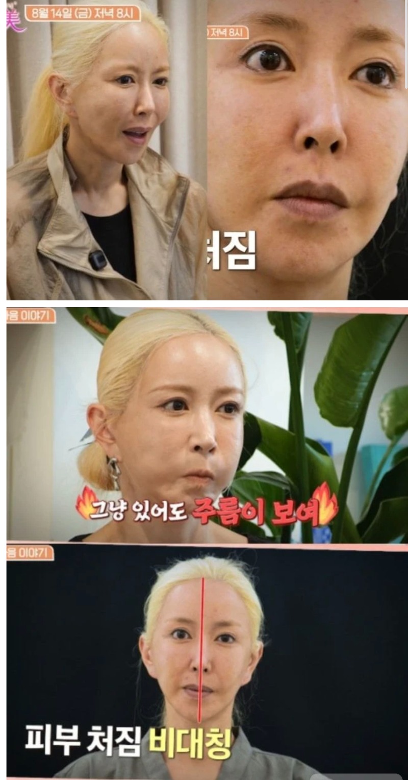 슈 근황